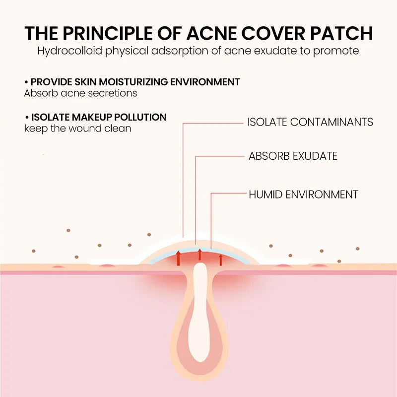 400Pcs Star Acne Patches Invisible Pimple Cover for Face Oil Control Spot Treatment Cute Sticker for Covering Zits and Blemishes