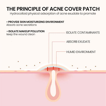 400Pcs Star Acne Patches Invisible Pimple Cover for Face Oil Control Spot Treatment Cute Sticker for Covering Zits and Blemishes