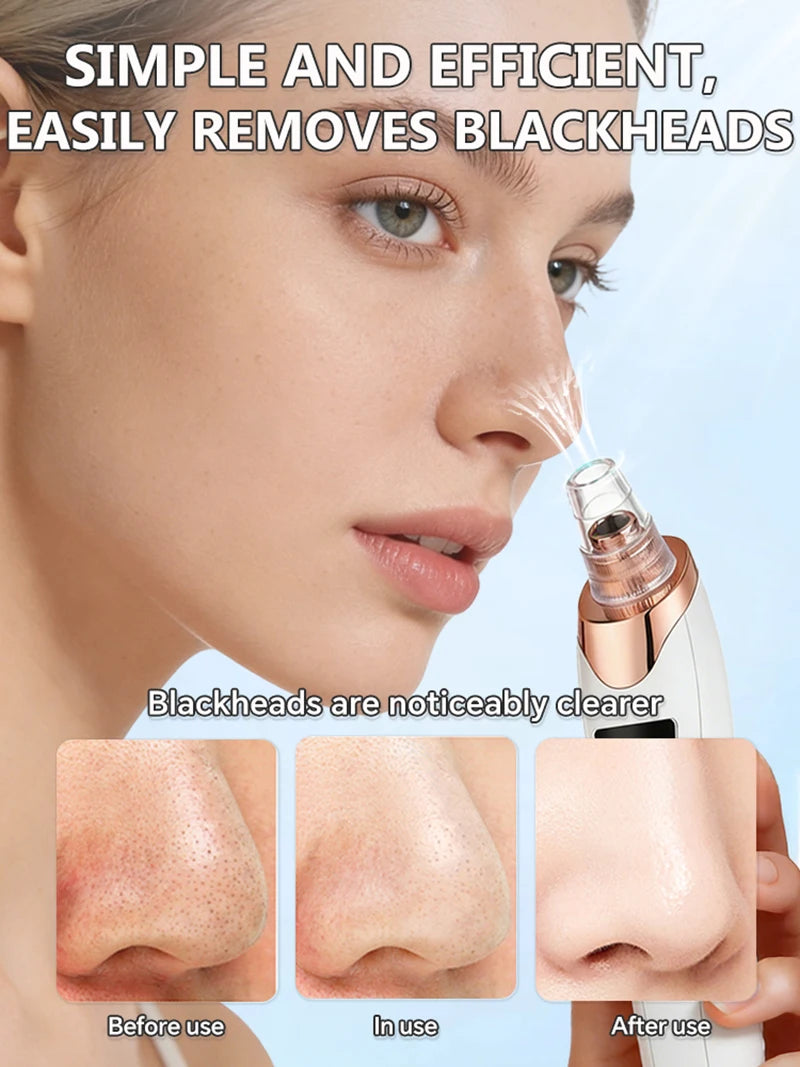 Electric Blackhead Remover Vacuum Acne Cleaner Black Dots Removal Facial Deep Cleansing Pore Cleaner Machine Skin Care Tools