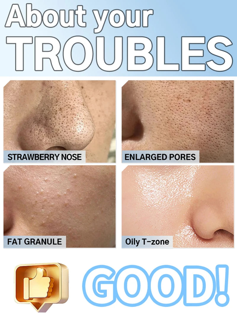 Electric Blackhead Remover Vacuum Acne Cleaner Black Dots Removal Facial Deep Cleansing Pore Cleaner Machine Skin Care Tools