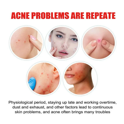400Pcs Star Acne Patches Invisible Pimple Cover for Face Oil Control Spot Treatment Cute Sticker for Covering Zits and Blemishes